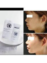 スリー 桜木町(Three)/LMC脂肪分解【桜木町】