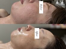 ジョーヌ(JAUNE)/横顔美人へ