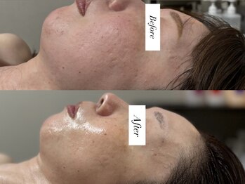 ジョーヌ(JAUNE)/横顔美人へ