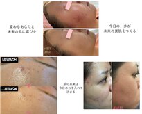 美肌ラボ シーズンズ(SEASON'S)