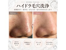アンジュ ヴィスパ(Ange Vie Spa)の雰囲気（皮脂詰まり・黒ずみ・ざらつき等、毛穴トラブルに）