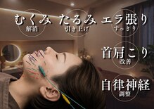 カロン(KALON)