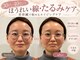 ソラナ(Solana)の写真/たるみ、ホウレイ線でお悩みの方に☆お顔の印象を変えたい方にオススメ！美容鍼灸でお肌のお悩みを徹底改善