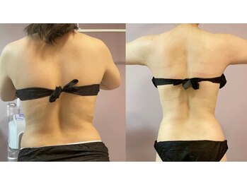 ウィステリア(WISTERIA)/モニター様効果