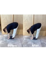 徳島藍住整骨院 ザ ビー(THE B)/ピラティス初回体験before/after