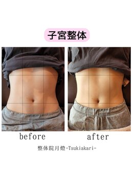 整体院 月燈/お客様写真