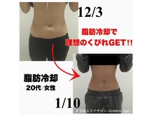 ウエスト/二の腕/お尻/背中/太もも等…続きを見る
サンライズビューティー
- エステ
- リラク
都度払いOK!全身脱毛22000円/3箇所脱毛5500円/最新機器スポットシミケア1箇所550円/ホワイトニング4400円
今話題のウルトランスフォーマー導入店!筋膜リリースで超小顔効果!痩身・肩こりにも♪筋膜小顔フェイシャル、脱毛、キッズ脱毛、RFフォト、EMS…続きを見る
最強温活痩身YOSAPARK MirrorUP
- エステ
- リラク
- リフレッシュ
【30-40歳からの本気ダイエット】本格リンパ×水素温熱×天然ハーブで滝汗デトックス!痩せるなら今◎
見た目も内臓脂肪も落とす!細胞レベルで変わるオトナ女子の究極のダイエット!独自のリンパケアで冷えた脂肪を分解&デトックス!微細ミストに包まれ…続きを見る
エステサロン Bellissimo 本店
- エステ
- リラク
- リフレッシュ
【11月限定クーポン登場!!】8種から選べるオーダーメイド脂肪撃退コース4回¥24750⇒¥4990/早い者勝ち
《痩身・美肌・脱毛・ブライダルのトータルビューティサロン》全ての肌悩みに対応改善出来ます!特に小顔ケア・毛穴ニキビ・たるみ改善 症例多数有☆…続きを見る
大幅減量!超本気ヤセ☆【短期でマイナス10痩せ★115分×2回¥13750】マシン多種×高技術ハンドで結果出し!
結果重視サロン★【痩せたい◎セル脂肪どうにかしたい!そんな方に!】熟練ハンドテクニック&最先端マシンを駆使し最高の結果をご提供♪従来のエステ…続きを見る
がんばる女性の変わりたいを応援!食べながら無理せず引き締めて理想の身体に
結果で選ばれる痩身サロン。分解、燃焼、排出すべてにアプローチをして痩せにくくなった身体を整え理想のボディラインに食べながら痩せたい、美しく引…続きを見る
ideal 【痩身サロン】UP
- エステ
- リラク
- リフレッシュ
- 整体・カイロ
空きあり☆「芯から燃やす!岩盤 浴×最新痩身マシン脂肪撃退×骨盤矯正でリバウンド防止」毛穴/小顔/痩身
【静岡希少!最強エステマシン★最新技術導入店♪】たるみなど痩身・美肌に最適なマシンを種類豊富にご用意◎あなたに合ったメニューを提供!20年以…続きを見る
本気で『痩せる』脂肪冷却&ダイエット痩身専門【全身セレクト♪360°冷却+キャビ体験★90分\9980】高評価
【年齢に関係なく大幅減量◎】『痩せる』に特化した業界注目の《脂肪冷却》で分厚い脂肪を燃焼・はみ肉にアプローチ!『老廃物排出』を促進するからサ…続きを見る
【痩身・ブライダル・フェイシャル・小顔・アイラッシュ】医療提携Lea上野/御徒町店UP
- エステ
- リラク
- リフレッシュ
- ネイル
- まつげ・メイク
11/26空き◎痩身/肌改善/小顔ケアが得意★短期間で変わりたい大人女性が多数来店♪《女性専用サロン》
《女性専用》Leaが大切にしていること!一人ひとりに合わせた**“オーダーメイド施術”**「流れ作業」ではありません。お客様の肌質・体質・生…続きを見る
MA BELLE ~マベール~
- リラク
- エステ
- 整体・カイロ
口コミ300件超★ミスユニバース御用達!大人女性の代謝促進【筋膜リリース/小顔コルギ】老廃物の排出を促進!
2024ミスユニバース/ミセスSDGsジャパン静岡サポーター店!世界水準&静岡希少【CIDESCO認定店/認定講師】!人気のコルギは大人女性…続きを見る
脂肪 燃焼 サプリに関するおすすめサロン情報
![ゴールデンエイジ(Golden Age)