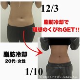 ゴールデンエイジ(Golden Age)