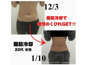 ゴールデンエイジ(Golden Age)