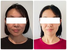 ウェリナ平和堂長久手院/小顔矯正/骨盤矯正/美脚サロン