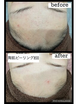 ナムズ(Nams)/ビフォーアフター