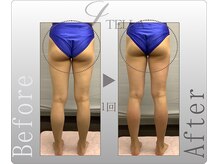 ステラ(STELLA)/下半身プレミアムの効果