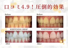 ホワイトニングショップ 府中店