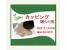 カッピング(吸玉)20分【クーポン詳細要確認】