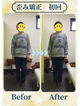 アミーゴ整体院/ビフォーアフター