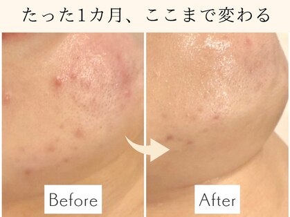 ロイヤル ビューティー サロン(Royal Beauty Saloon)の写真
