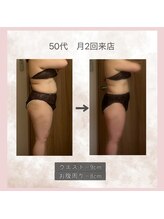 エメカシワ(Aimer KASHIWA)/50代　4ヶ月での変化