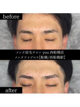 ユー 西船橋店(you)/ビフォーアフター写真