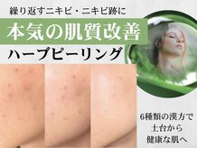 リンダ 西宮(Linda)