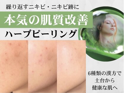 リンダ 西宮(Linda)の写真