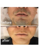 アトレ(Atre)/シェービングストレス解消！