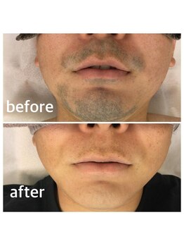 アトレ(Atre)/シェービングストレス解消！