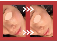 サロン デ ミロ(Salon de Miro)/BeforeAfter多数！ブログへGO♪