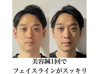 ヒールジョイ(HEAL JOY)