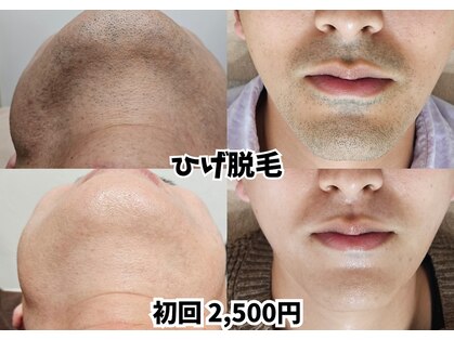 オレオマ(OLEOMA)の写真