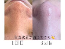 ネムレル森(Nemureru森)の雰囲気（お肌への負担が少ないのに効果を実感いただけております♪）