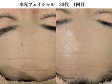 サンビ(SANBI)/しわケアには保湿を