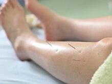 辻鍼灸接骨院/経絡調整