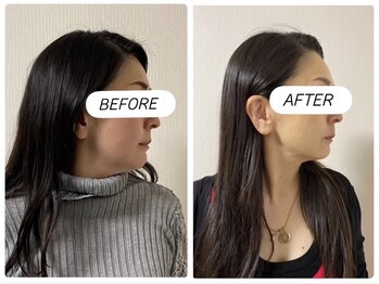 アプロディタ/輪郭、肌質、肌色すべてに期待大