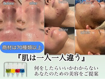 インチャント(enchant)