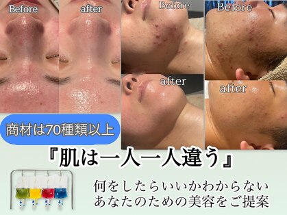 インチャント(enchant)の写真