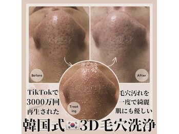 ルアナ(Luana)の写真/SNSで話題の【韓国式3D毛穴洗浄】導入！北区では希少な【韓国式3D毛穴洗浄】で毛穴レス陶器肌へ導きます♪