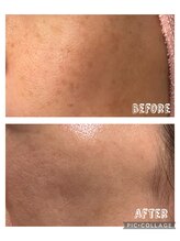 いおり骨盤整体 リブート(RE:BOOT)/ララピール&シミケア