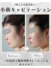 【-3kg見せ】小顔/顔の脂肪分解キャビテーション