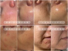 フォー(For...)の雰囲気（肌質改善特化サロン|結果重視！豊富なピーリングで効果実感◎）