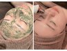 艶肌効果♪理想のお肌に【ハーブピーリング＋毛穴吸引】若見え効果◎