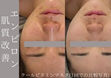 美容整骨サロン リペア(Repair)