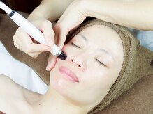 ミラン(MiLaN)/毛穴洗浄/ハイドラヴィーナス