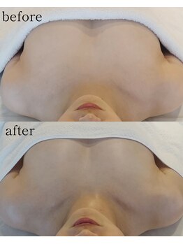 ブルーム(bluem)/グラマーさん必見！