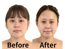 チェイル(JEIL)の雰囲気（即こう性◎エラ、食いしばりにも）