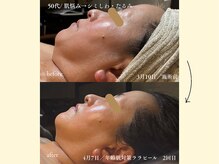 パンセリーノ(Panselinos)