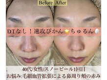 アイミー(i:mee)の雰囲気（ハーブピーリングを検討中の方に人気。肌質改善/毛穴/くすみ）