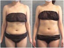 美容整体 ウェリナ 蟹江院/小顔矯正/骨盤矯正/美脚サロン 