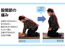 セルフケア整体 新宿店/実際のお客様◆1来店 膝の痛み