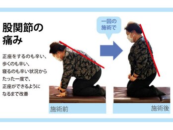 セルフケア整体 新宿店/実際のお客様◆1来店 膝の痛み