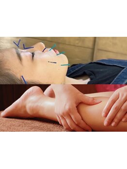 鍼灸施術を受けたい